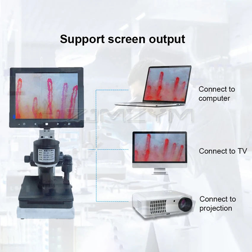 Digital Microscope Zoom Nailfold Capillary Microcirculation Detector Blood Microcirculation Analyzer with 7/8/9" Digital Screen