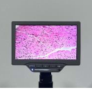 Lcd screen with 5 mega pixel camera for  trinocular microscope - 7 , 8 , 9 inches size